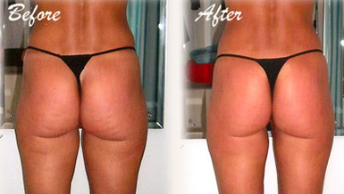 welcome-carousel-img